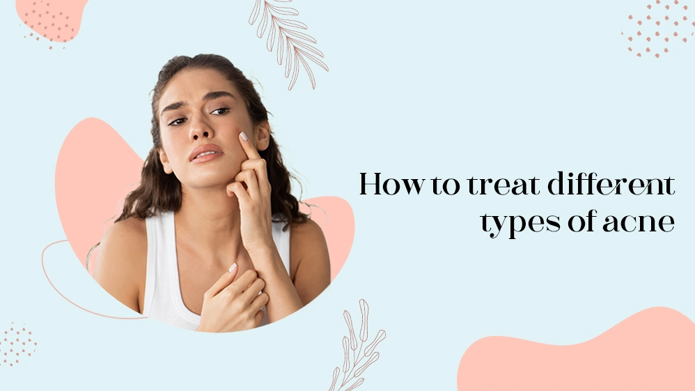 How to Treat Different Types of Acne