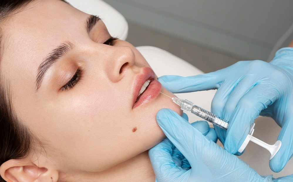 Lip Fillers Treatment
